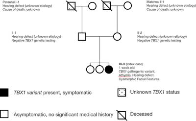 Case Report: Unmanipulated Matched Sibling Donor Hematopoietic Cell Transplantation In TBX1 Congenital Athymia: A Lifesaving Therapeutic Approach When Facing a Systemic Viral Infection